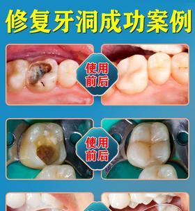 无牙洞攻略（深入了解无牙洞的地理特点和隐藏的宝藏）